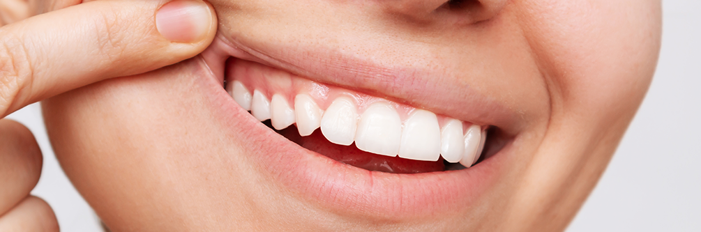 Beylikdüzü Diş Eti Tedavisi | Diş eti tedavisine mi ihtiyacınız var?